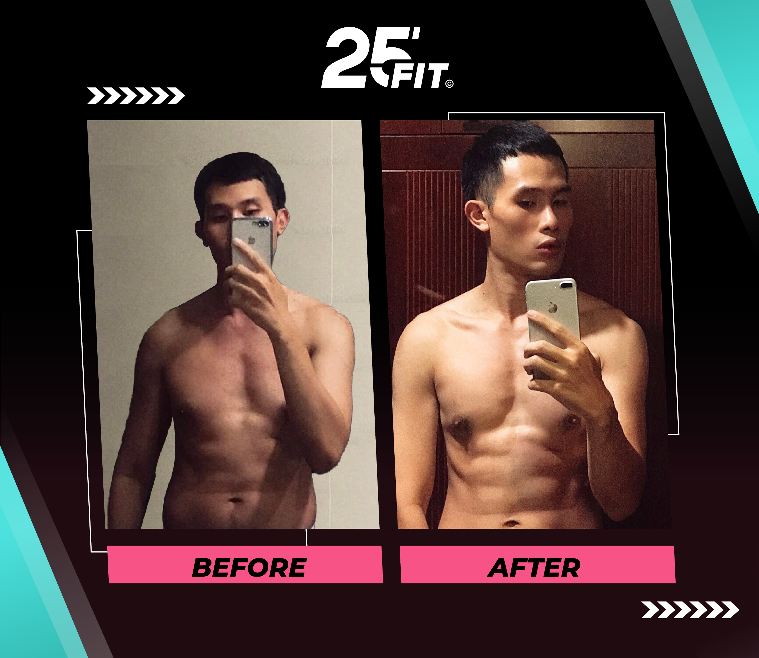 tam-biet-mo-bung-cung-25fit