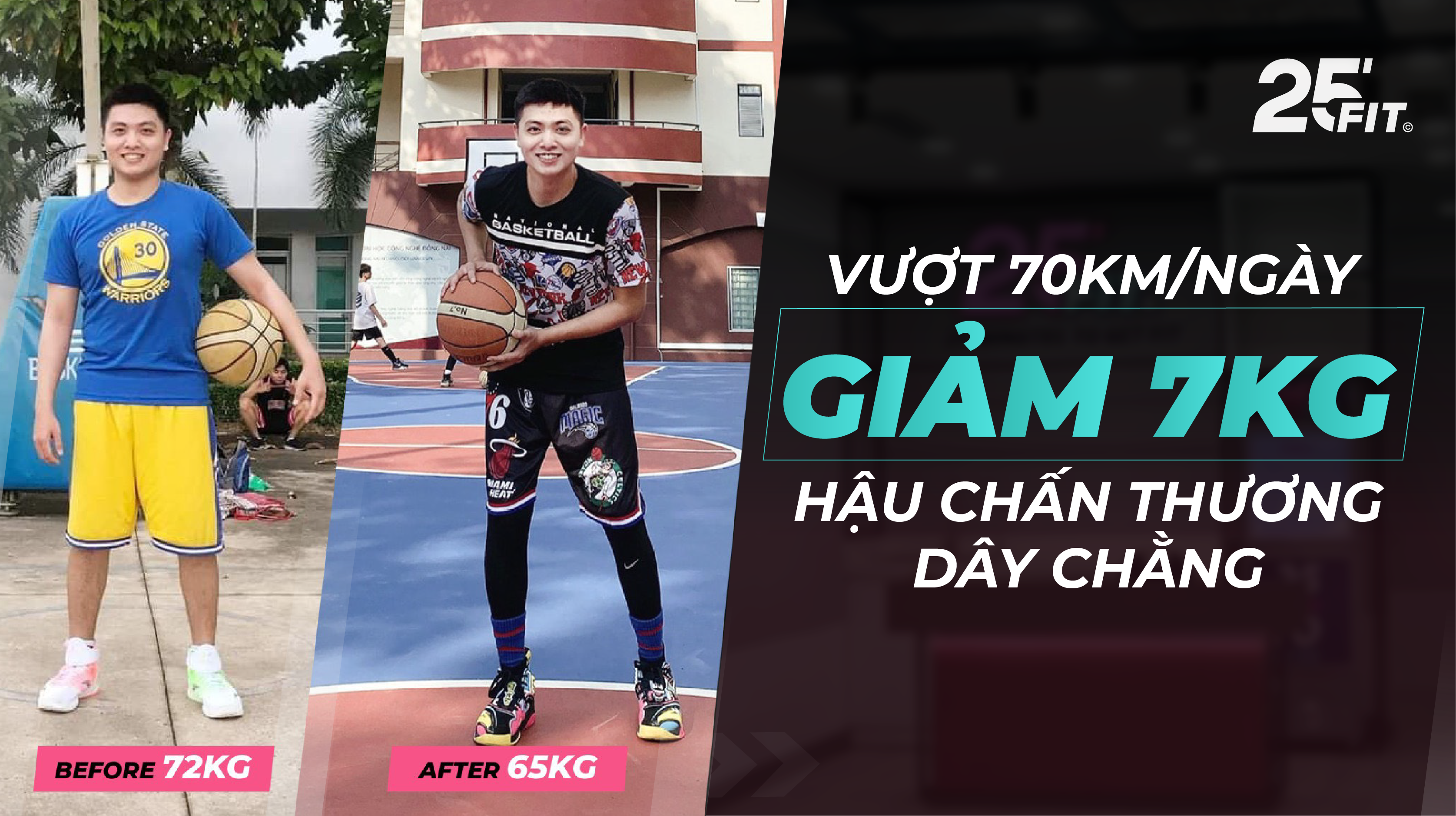 VƯỢT 70KM/NGÀY, GIẢM 7KG HẬU CHẤN THƯƠNG DÂY CHẰNG